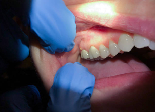 Best Emergency Gum Pain Relief  in Olive Hill, KY